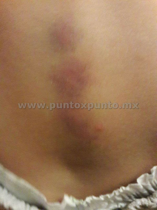 DENUNCIAN MALTRATO EN GUARDERÍA, MADRE ASEGURA SU BEBE FUE GOLPEADO.